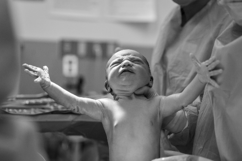 The Apgar Score Explained: Your Newborn’s First Test & What Every Parent Should Know